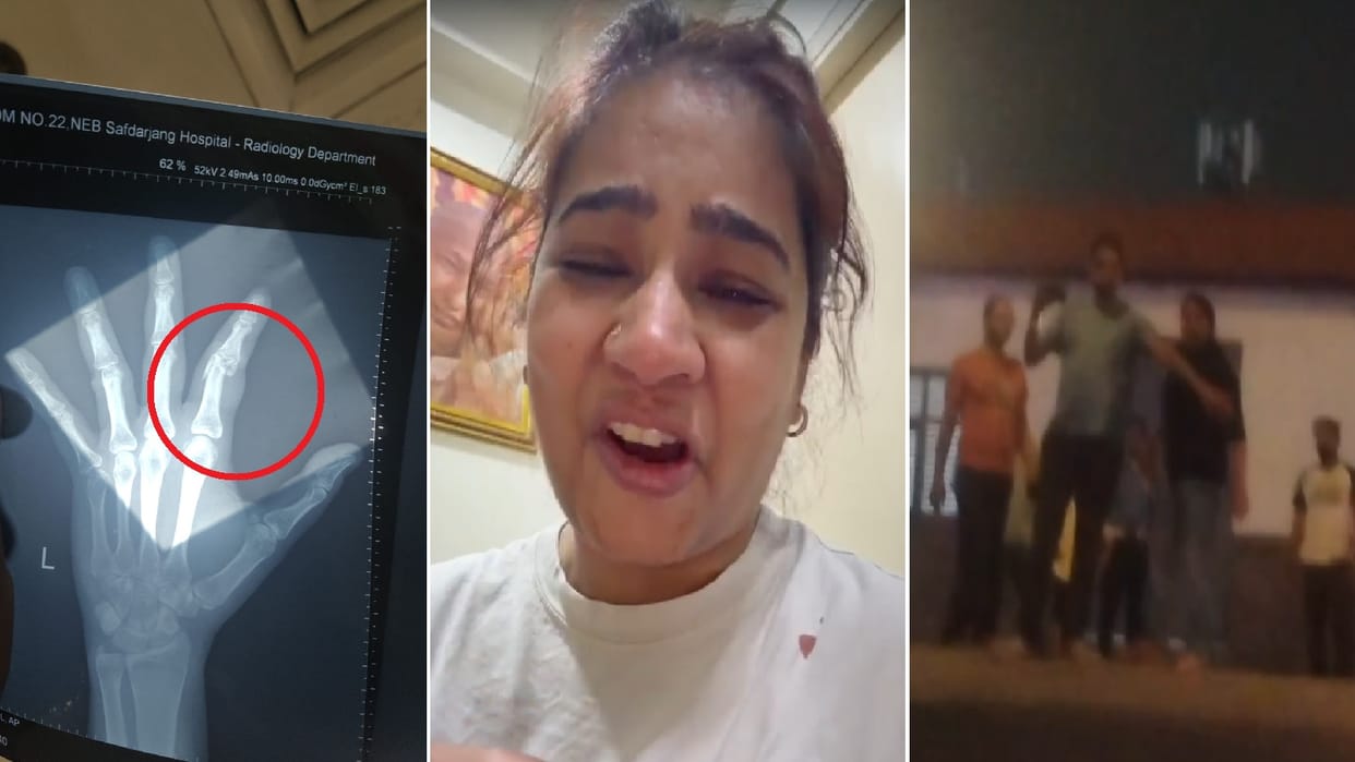 Altercation between a couple and an animal lover in society over a dog