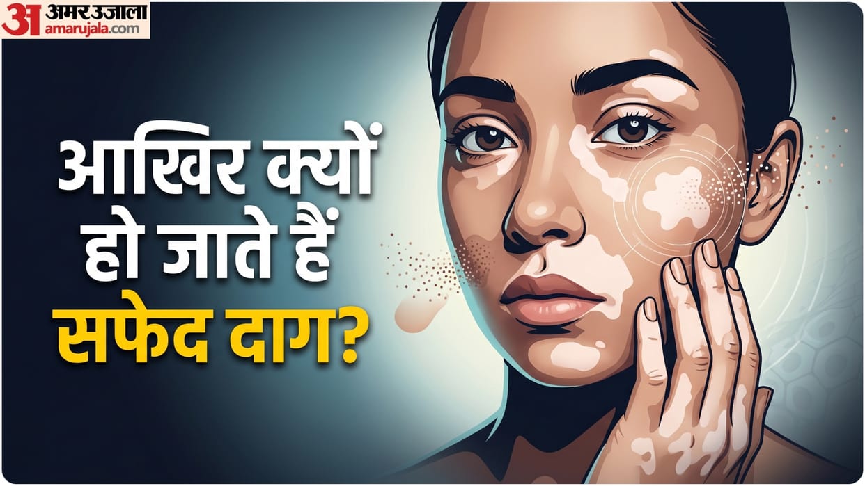 why is Vitiligo know its causes and risk factors skin par white spot kyu hota hai