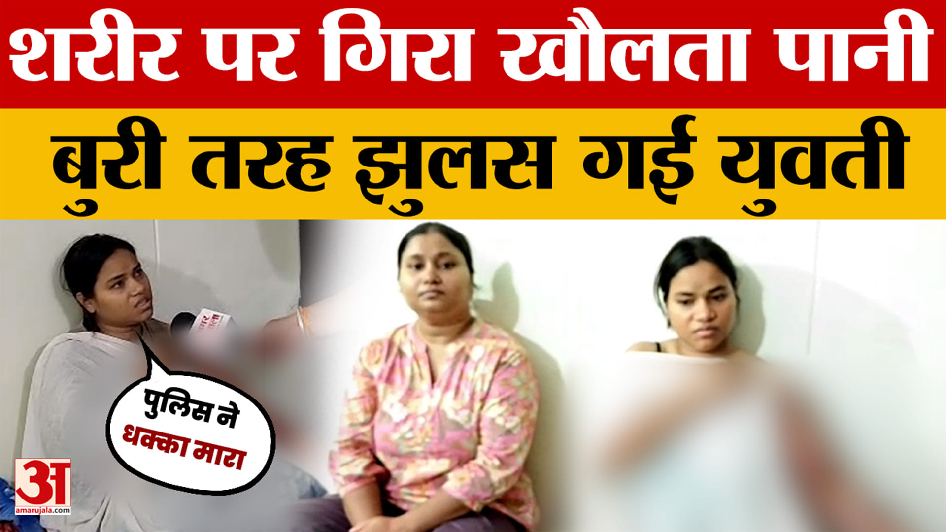 Rajasthan News: जयपुर में दिल दहला देने वाली घटना, युवती के ऊपर गिरा खौलता पानी | Amar Ujala