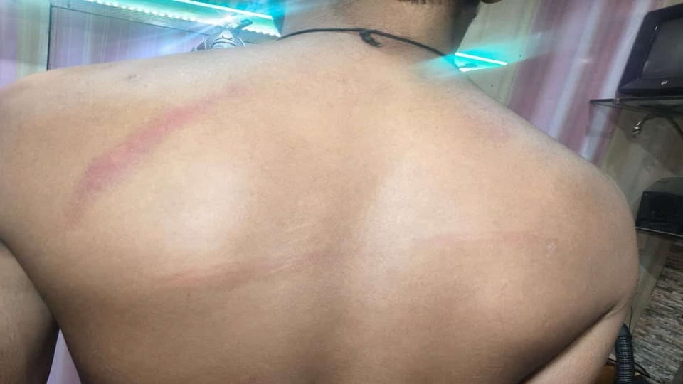 Property Dealer Alleges Abduction and Assault by Men Claiming to Be BJP Leaders