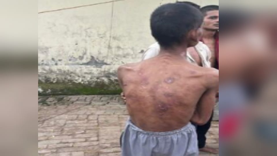 Muzaffarnagar Factory 12 Workers Rescued: Job Promise, Forced Labour, Pitbull Threat