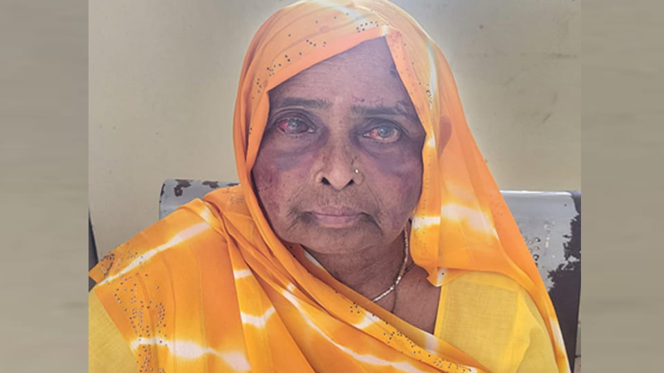 पुत्र की मारपीट से घायल वृद्ध महिला रामबेटी