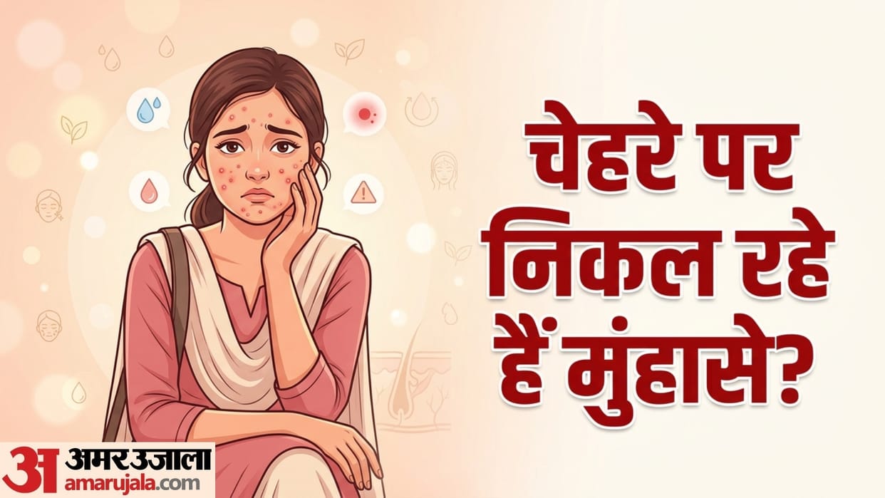 what causes pimples on face know muhase kyu hote hai how to prevent it