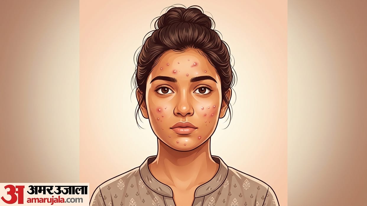 Why Did Small Bumps Suddenly Appear on Your Face? 6 Common Causes