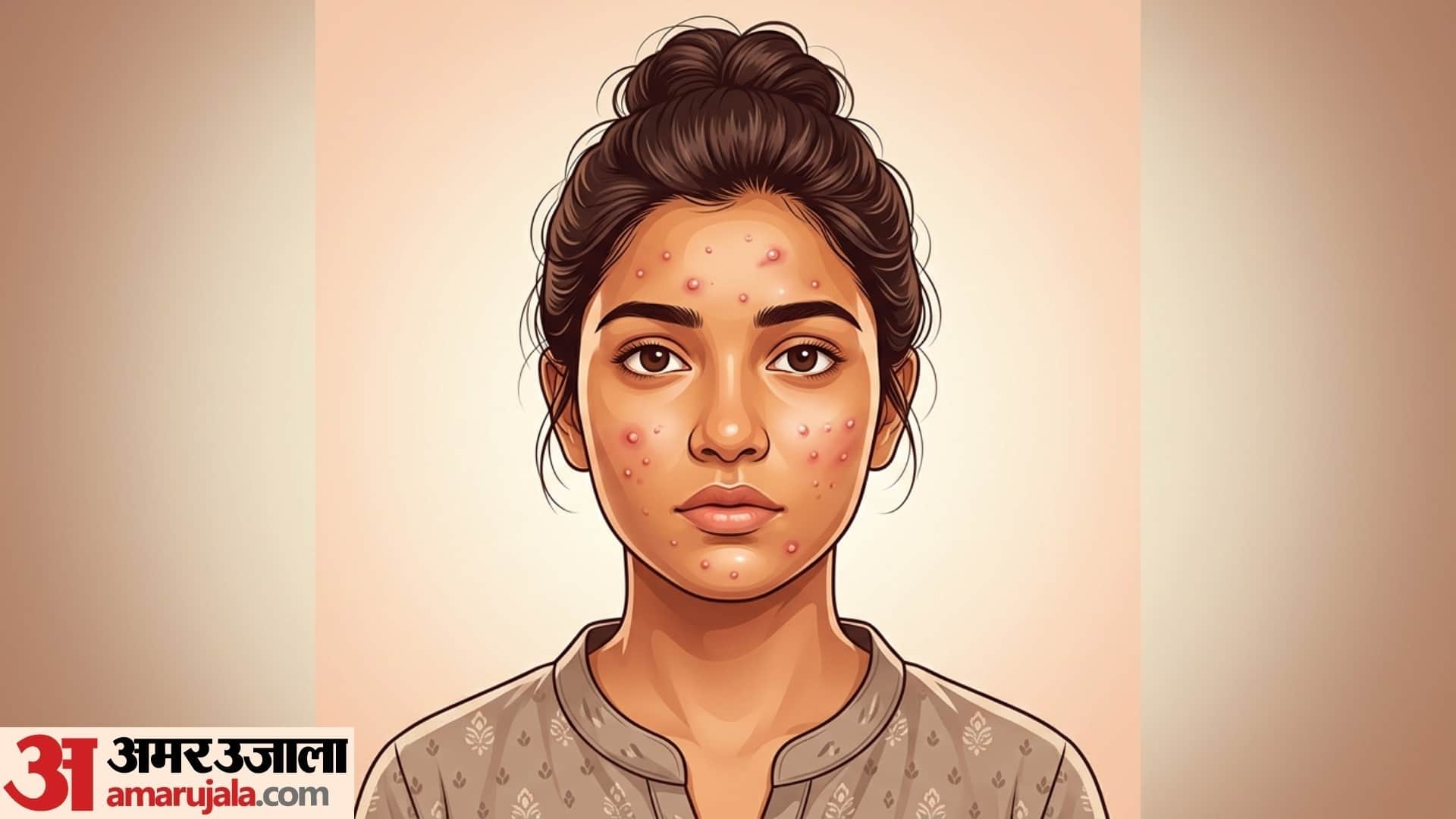 causes of pimples on face in teenage pimple kaise thik kare gharelu upay disprj