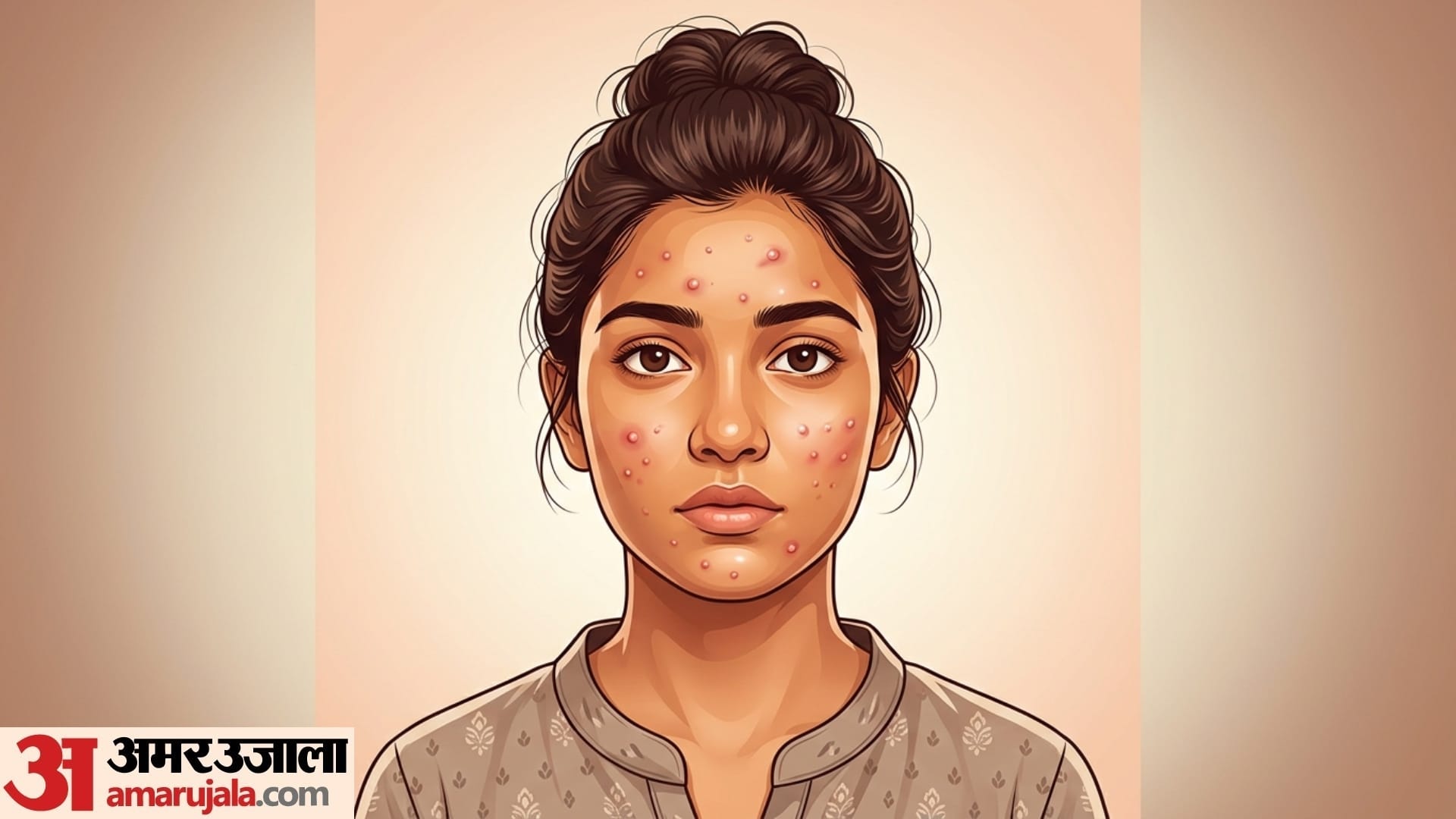 what causes pimples on face know muhase kyu hote hai how to prevent it