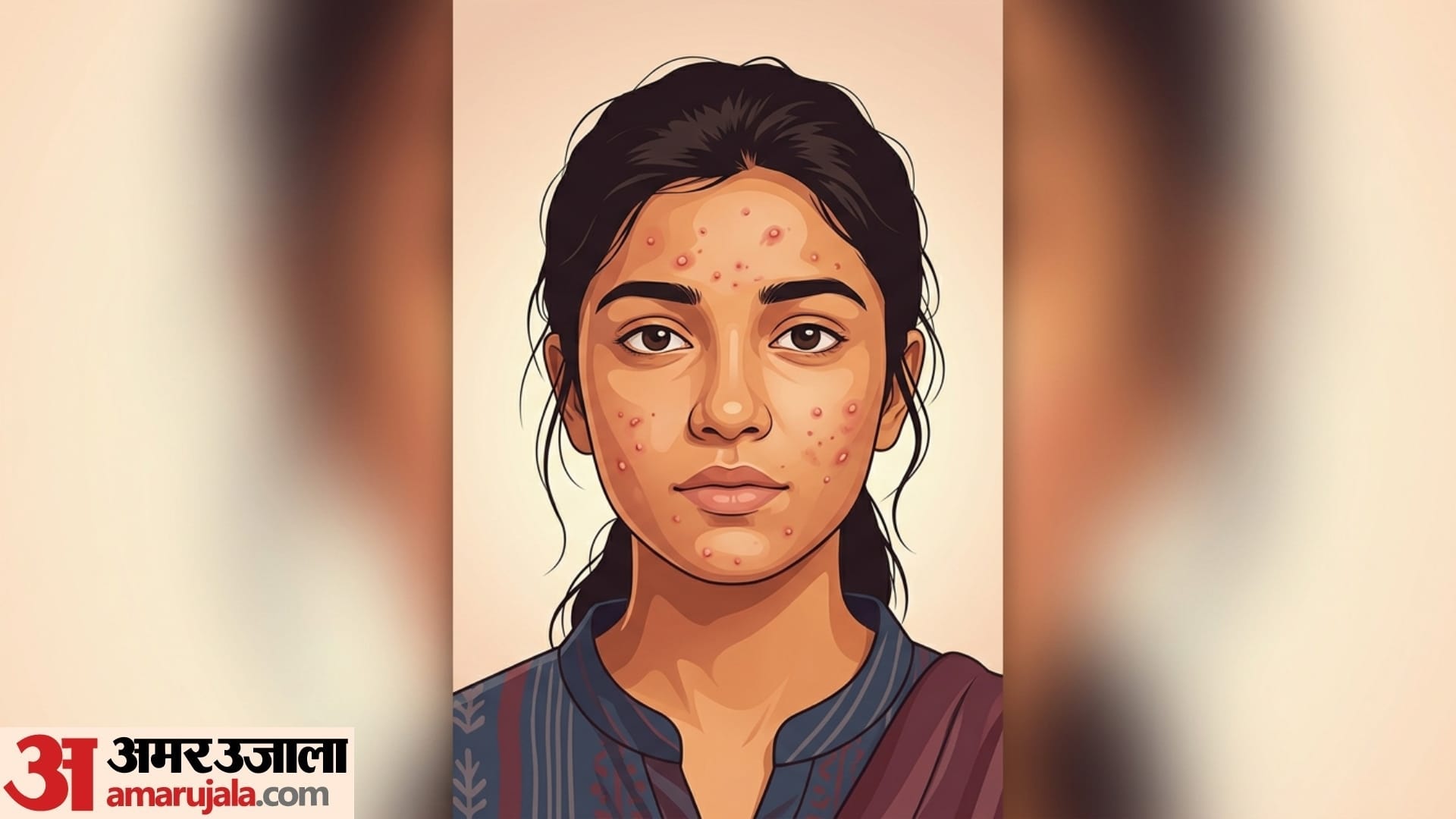 causes of pimples on face in teenage pimple kaise thik kare gharelu upay disprj