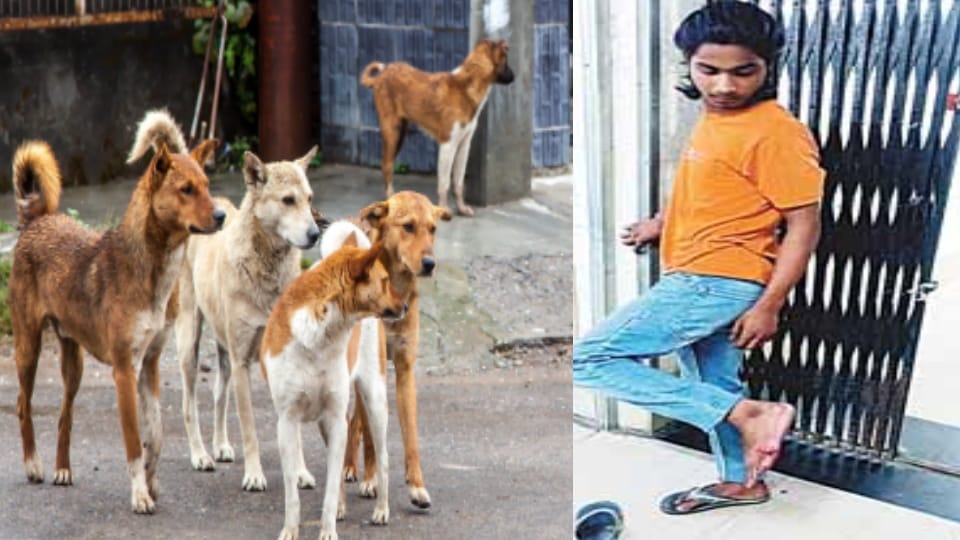 Meerut: Stray Dog Menace Grows in Meerut, Four Injured in Fresh Attacks, 151 Bite Cases Reported Daily
