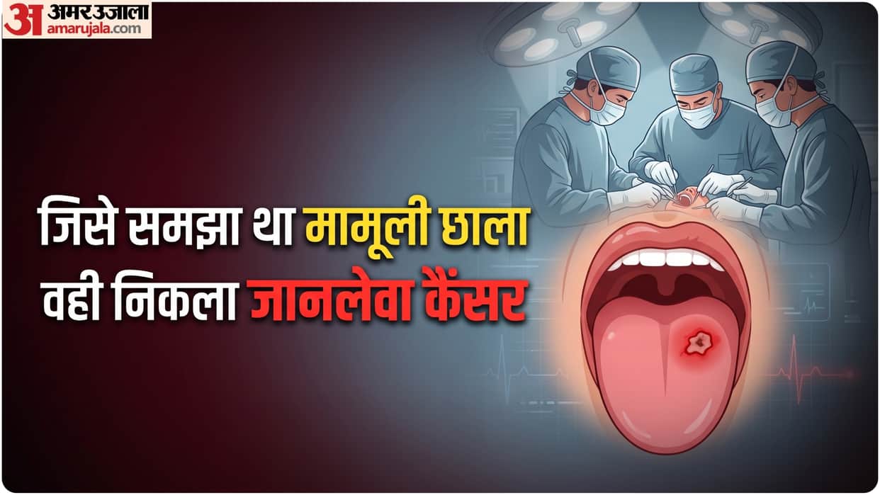 how small red spot in mouth turned into stage 2 t tongue cancer how we can avoid this risk