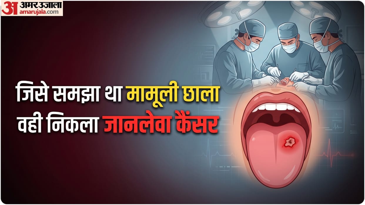 how small red spot in mouth turned into stage 2 t tongue cancer how we can avoid this risk
