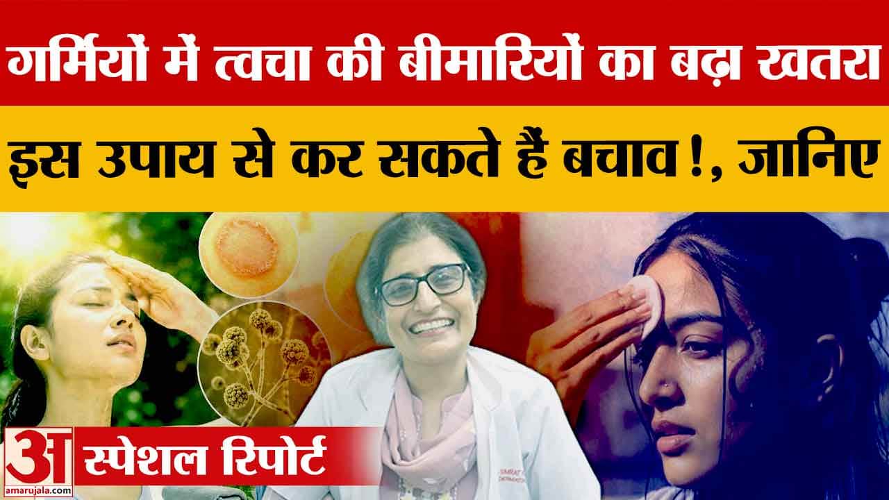 गर्मियों में त्वचा का रखें खास ध्यान, सनस्क्रीन और हाइड्रेशन जरूरी: डॉ. सिमरत कौर