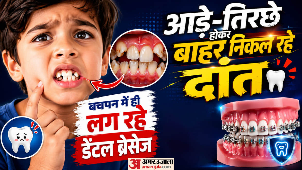 Shrinking Jaws Are Preventing Full Set of 32 Teeth 32 Teeth Theory Changing AIIMS Rishikesh Uttarakhand news