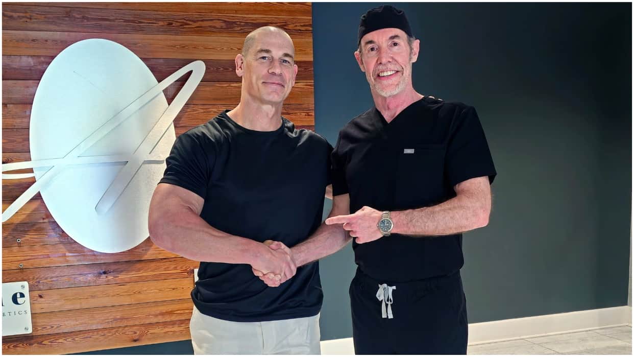 John Cena Shocks With Bald Photo Fans Praise Actor For Opening Up About Hair Transplant Shares Picture