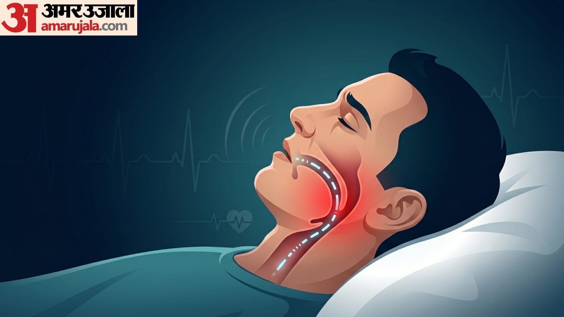 Health Tips snoring is the main cause of many health problem kharate kaise band kare gharelu upay