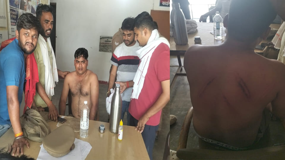 थाने में साथी सिपाहियों के साथ बैठा कोबरा का जवान व पीठ में चोट दिखाता सिपाही