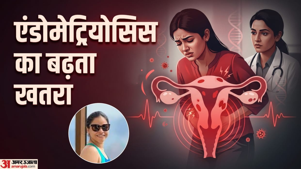 sumona chakravarti endometriosis surgery what cause endometriosis and its early symptoms