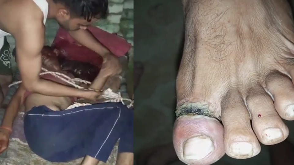 Husband tied to cot and scorched with electric shocks; head smashed after being struck with stick