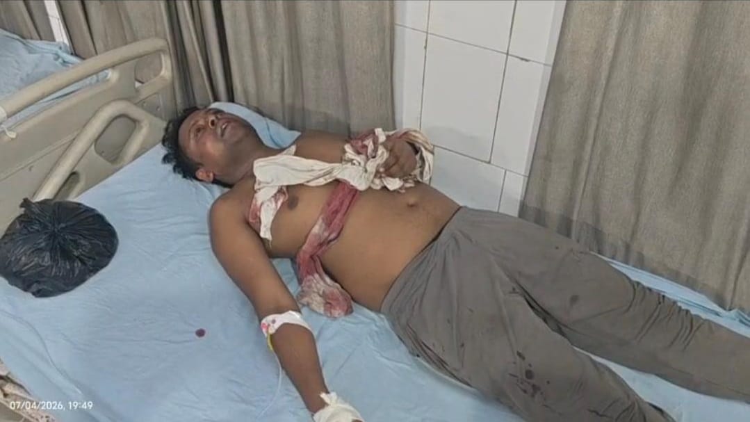 Hamirpur Youth subjected to third degree torture at police station SP transfers SI to police lines