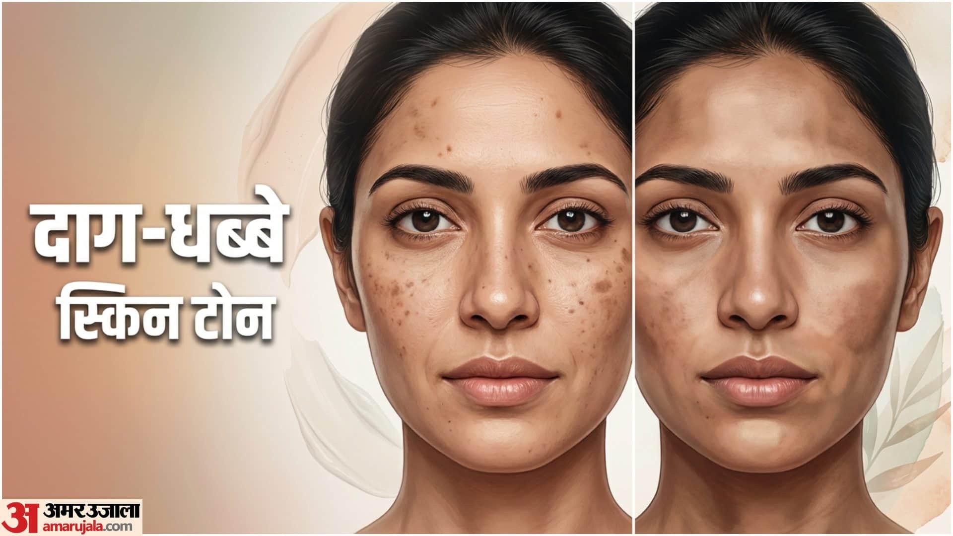 Natural Skincare Multani Mitti Benefits For Acne Oily Skin In Hindi