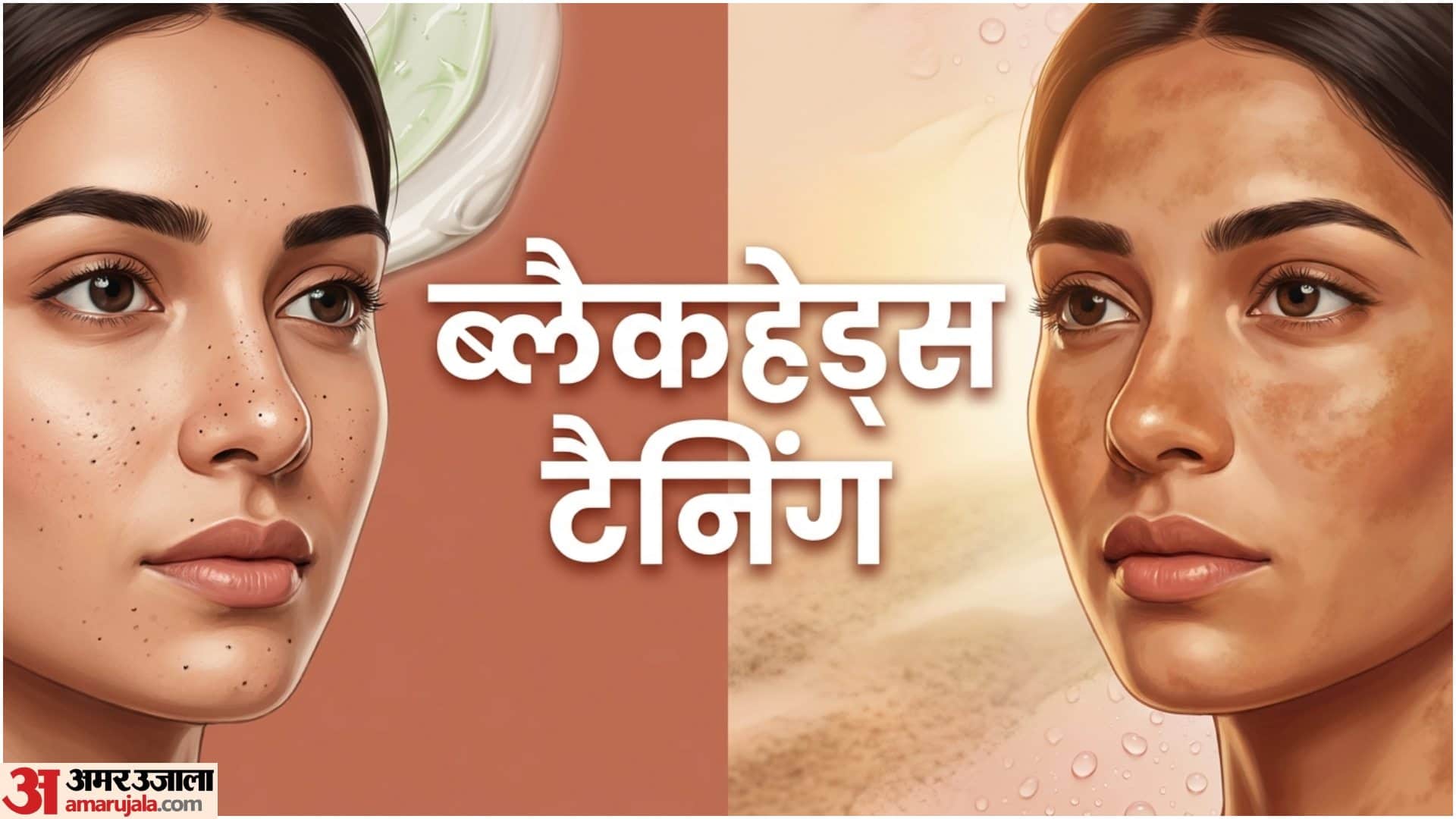 Natural Skincare Multani Mitti Benefits For Acne Oily Skin In Hindi