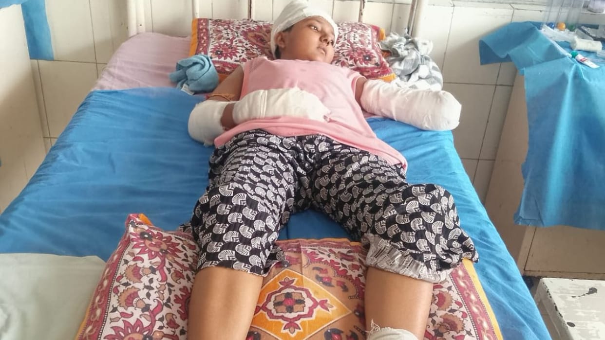 3-year-old Kirti lost her arm in an accident