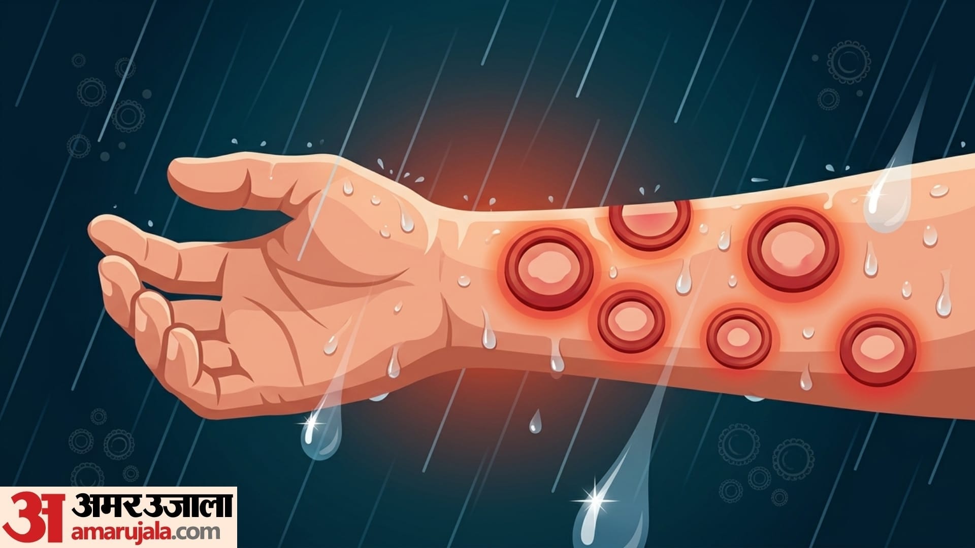 Monsoon Skin Diseases Causes & Prevention rain cause these skin problem in monsoon in hindi