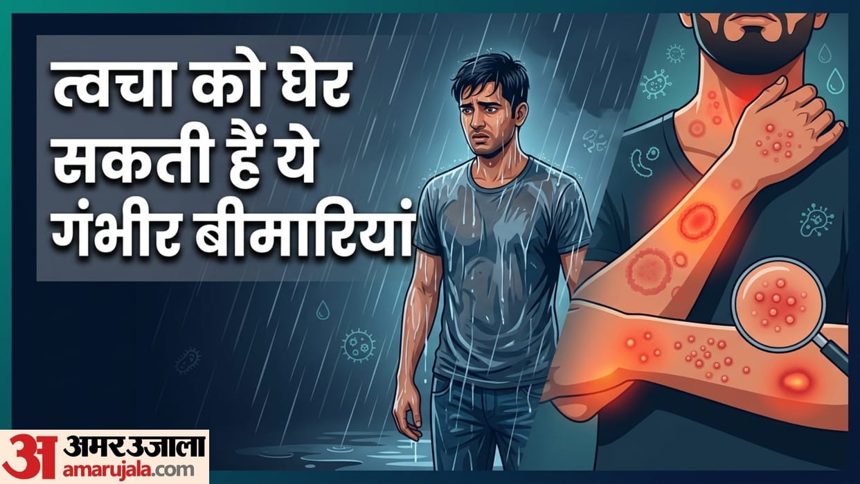 Monsoon Skin Diseases Causes & Prevention rain cause these skin problem in monsoon in hindi