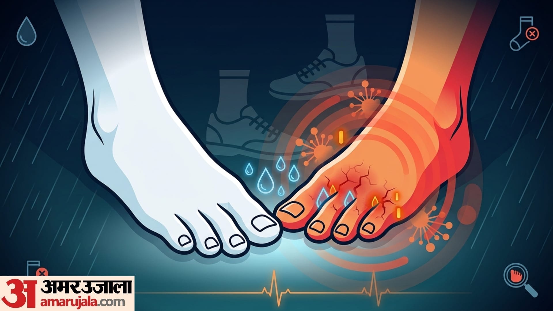 Monsoon foot Care 5 symptoms of yeast infection in foot in monsoon season