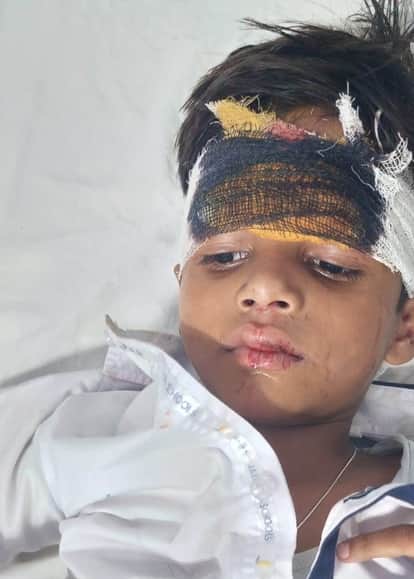 13 injured, including 11 children, as school bus falls into roadside ditch
