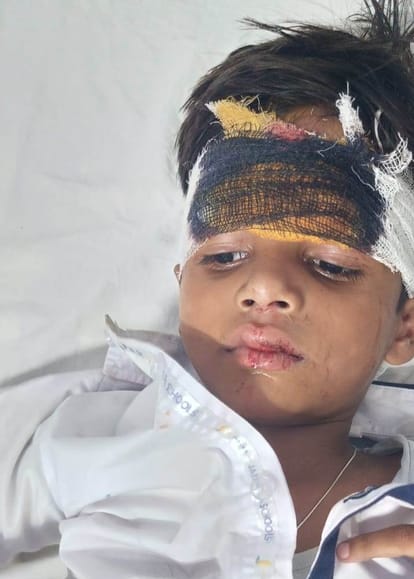 13 injured, including 11 children, as school bus falls into roadside ditch