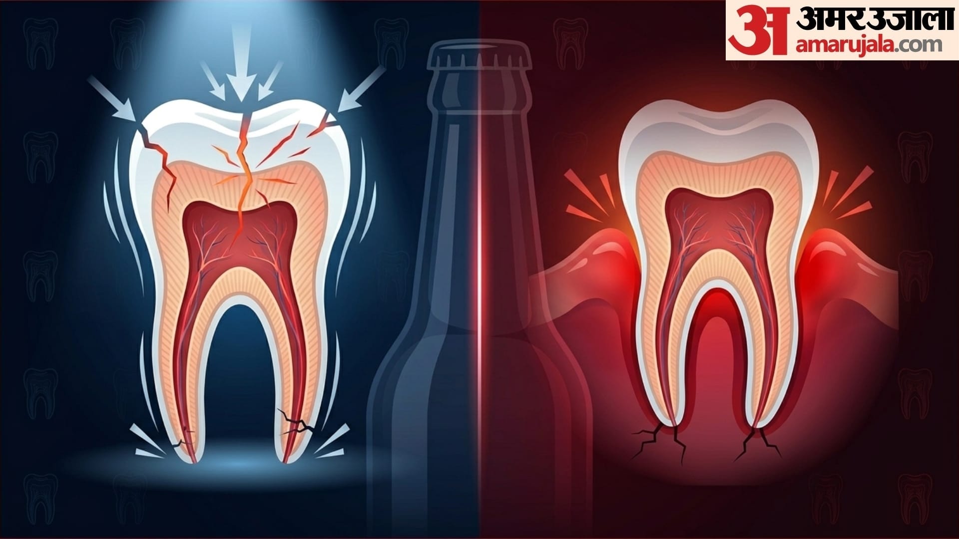 why tooth pain or sensitivity increases while weather change