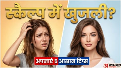 मानसून में बालों की समस्या का इलाज