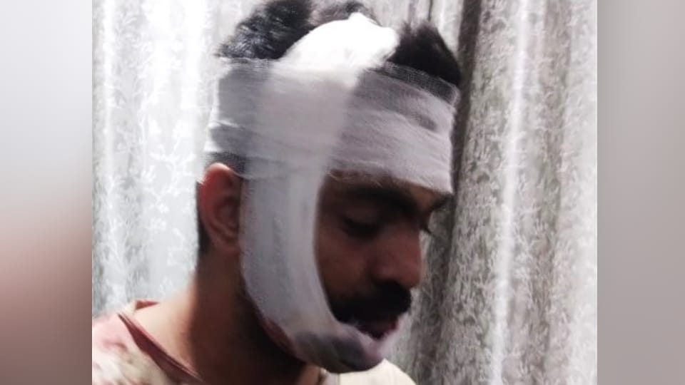 UP: Nilgai collides with two friends' bike; one youth dies, national-level basketball player injured.