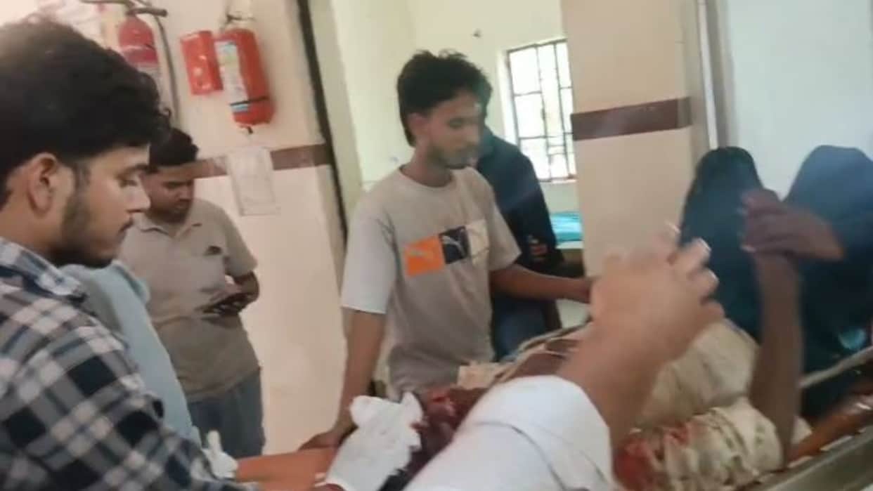 Gas cylinder explodes during welding three people suffer burns in Pilibhit