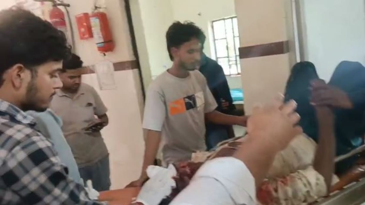 Gas cylinder explodes during welding three people suffer burns in Pilibhit