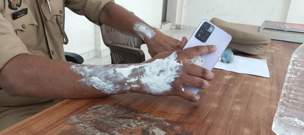 Kanpur Young man sets himself on fire at police station three policemen suffer burns while trying to save him