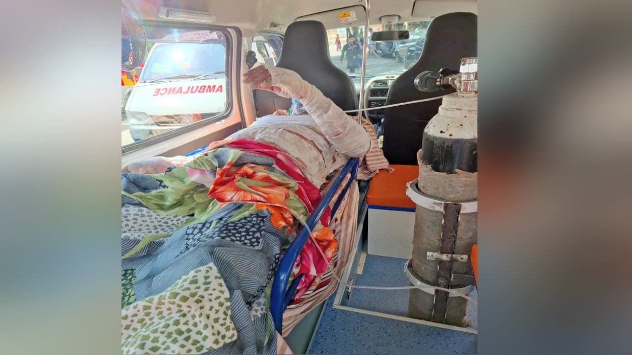 Three family members, including a mother and son suffered burns in a kitchen fire caused by a leaking gas cyli
