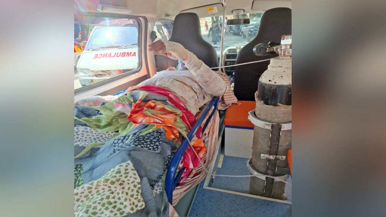 कुल्लू में आग से तीन लोग झुलसे।