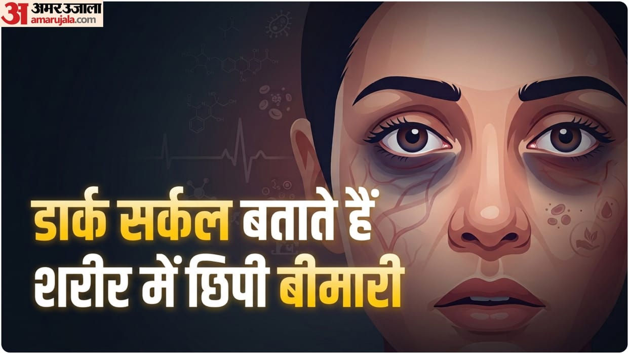 why dark circles happen even after good sleep diseases behind this