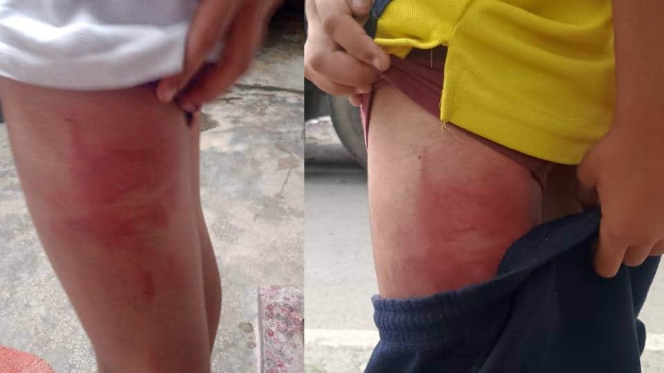 Teacher brutally beat student in Lucknow for not completing homework complaint filed at police station