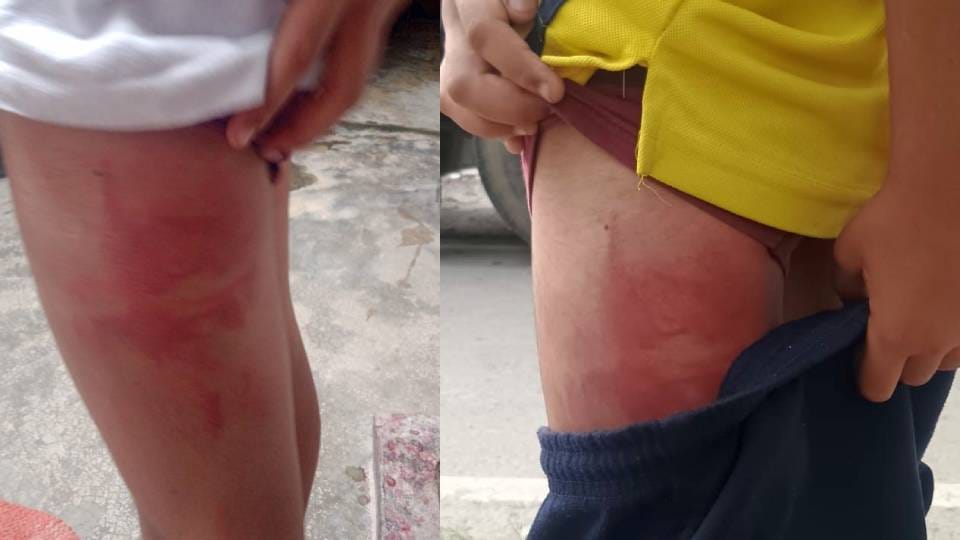 Teacher brutally beat student in Lucknow for not completing homework complaint filed at police station
