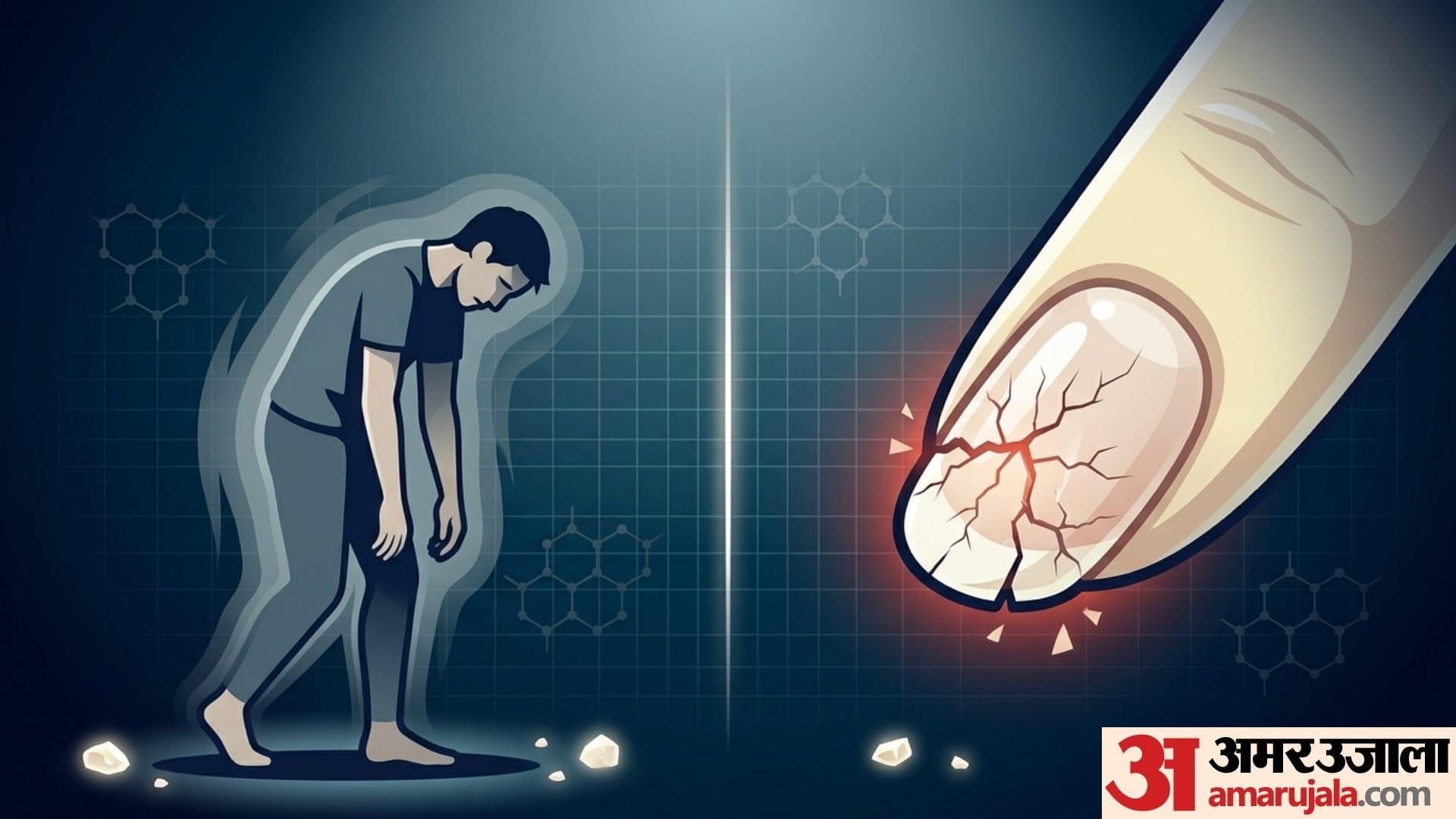 symptoms of calcium deficiency in males and female both in hindi calcium ki kami ke lakshan