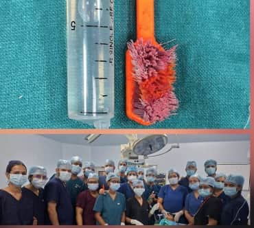 ब्रश और चिकित्सकों की टीम