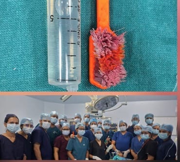 ब्रश और चिकित्सकों की टीम