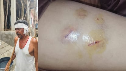 बंदरों के हमले से घायल ग्रामीण
