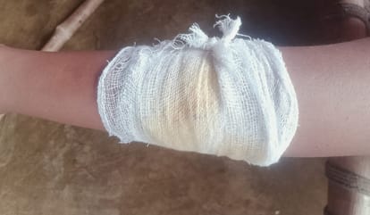 Kanpur Monkey menace in Narayanpur dozen people injured in week villagers say no action has been taken so far