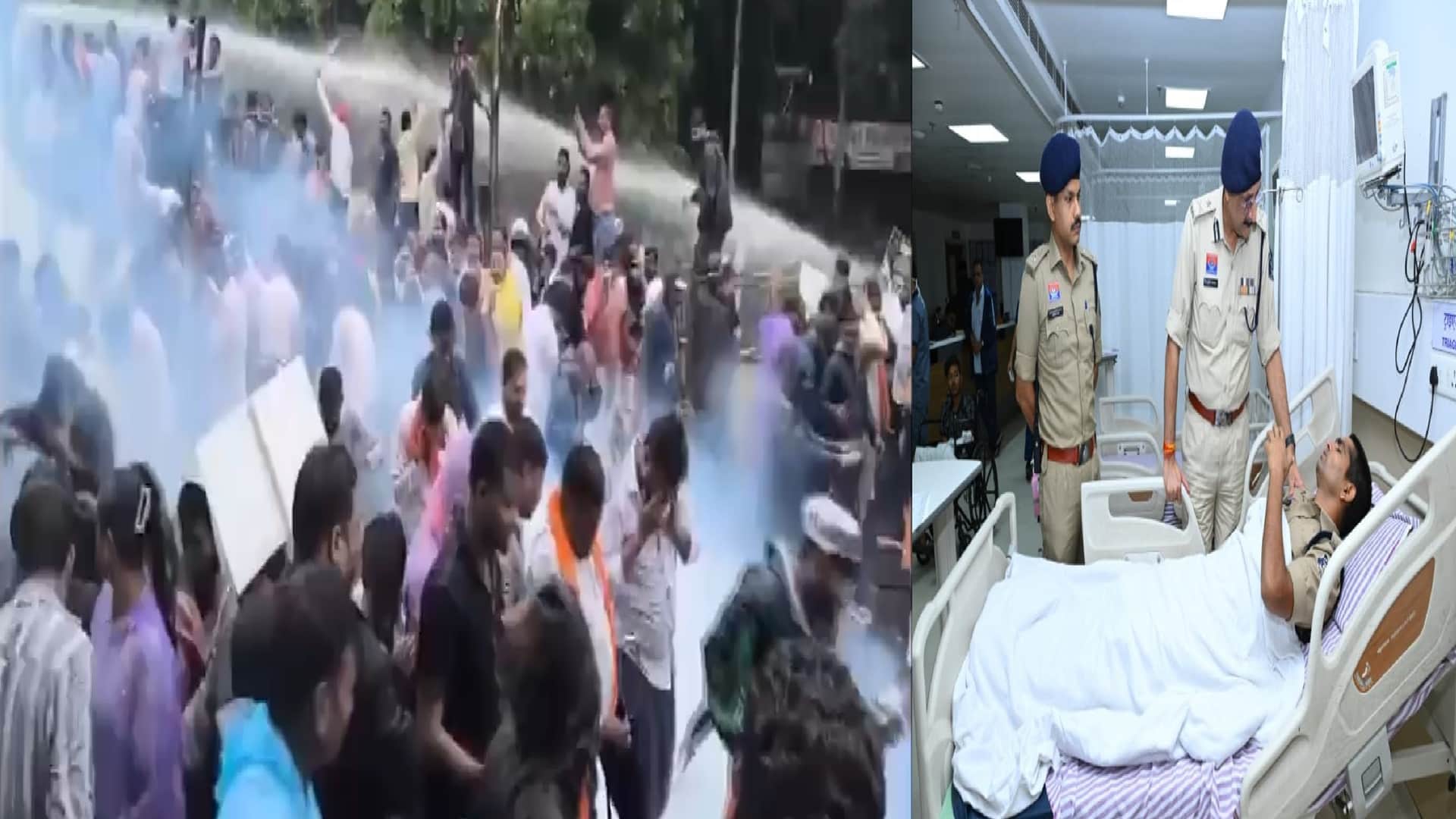 बीजेपी-कांग्रेस के बीच टकराव, घायल जवानों से मिलने अस्पताल पहुंचे पुलिस कमिश्नर
