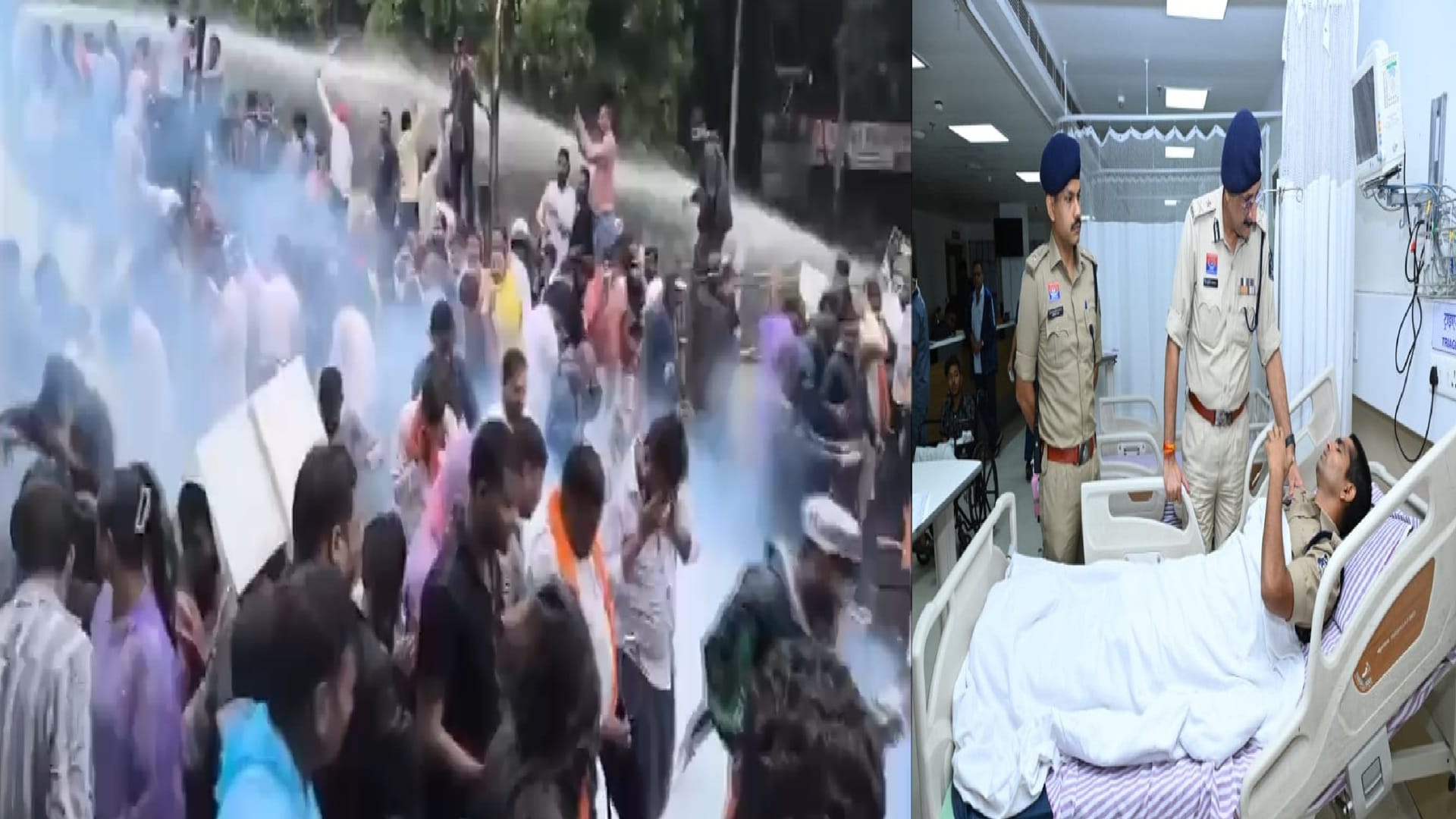 बीजेपी-कांग्रेस के बीच टकराव, घायल जवानों से मिलने अस्पताल पहुंचे पुलिस कमिश्नर