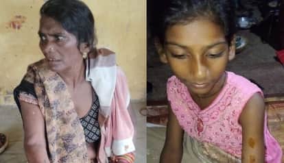 Kanpur Dogs bit 30 people in three days villagers killed one becoming aggressive due to infection
