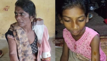 Kanpur Dogs bit 30 people in three days villagers killed one becoming aggressive due to infection